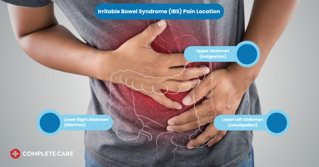 IBS-related pain: locations and causes